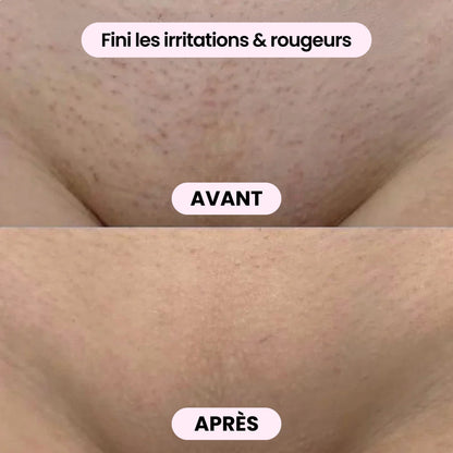 Máquina 2 em 1 corpo e biquíni - BODYKLYNE